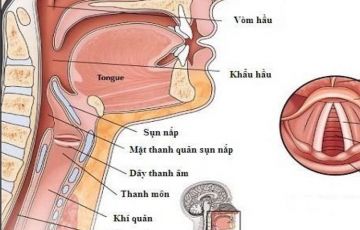 Rối loạn giọng nói.